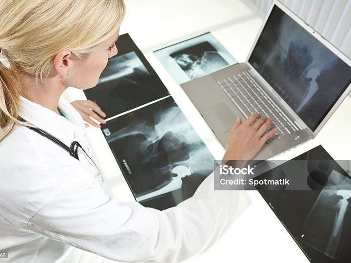 Ärztin mit Röntgenbildern und Laptop