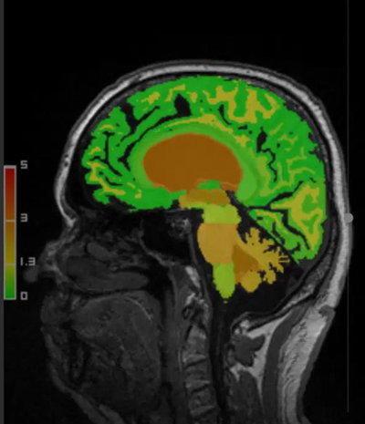 Volumenmessungen zur Bestimmung von Abweichungen anhand einer A.I. Software (2024)