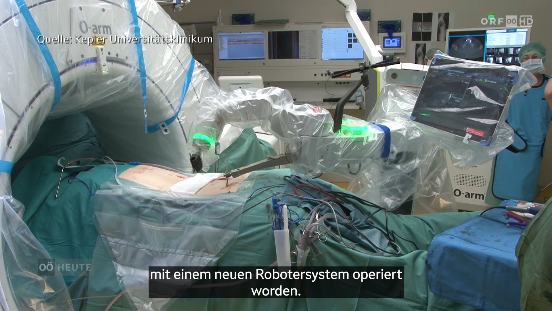 Roboter assistiert bei Operationen an der Wirbelsäule