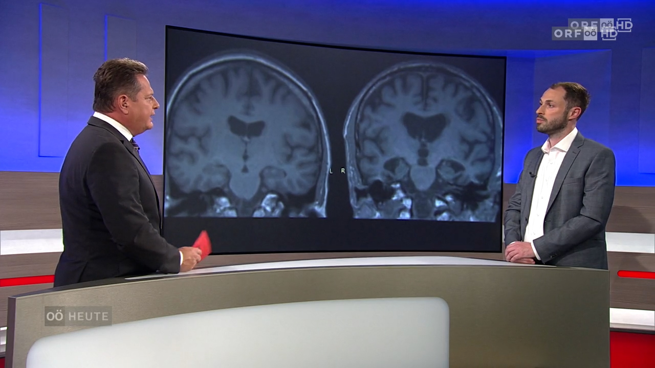 OA Dr. Matthias Zeller zum Thema Alzheimer