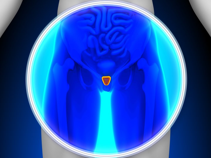 Grafik eines Menschen mit rot gekennzeichneter Prostata
