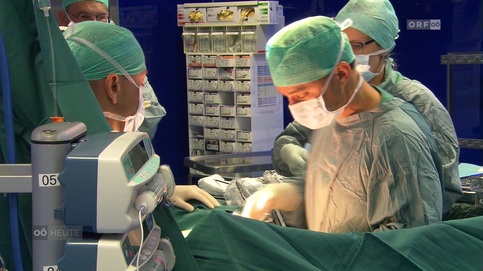 Minimalinvasive Darmchirurgie – neue Technik minimiert Anastomoseninsuffizienz