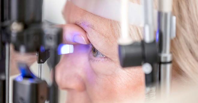 Augenuntersuchung mit der Spaltlampe