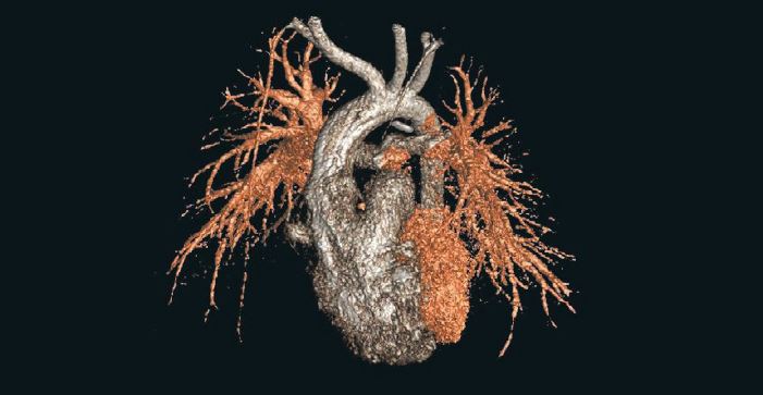 Grafische Darstellung eines Herzens mit Gefäßen