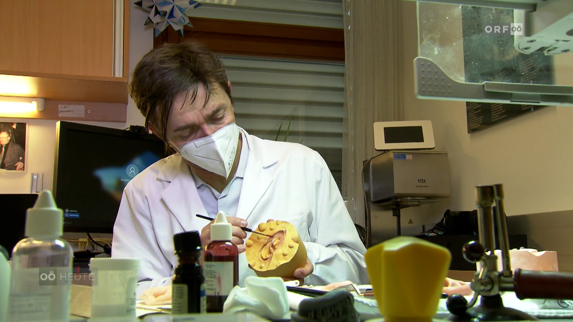 Die Epithetik (Gesichtsprothetik): Ein Spezialbereich mit Forschungspotential